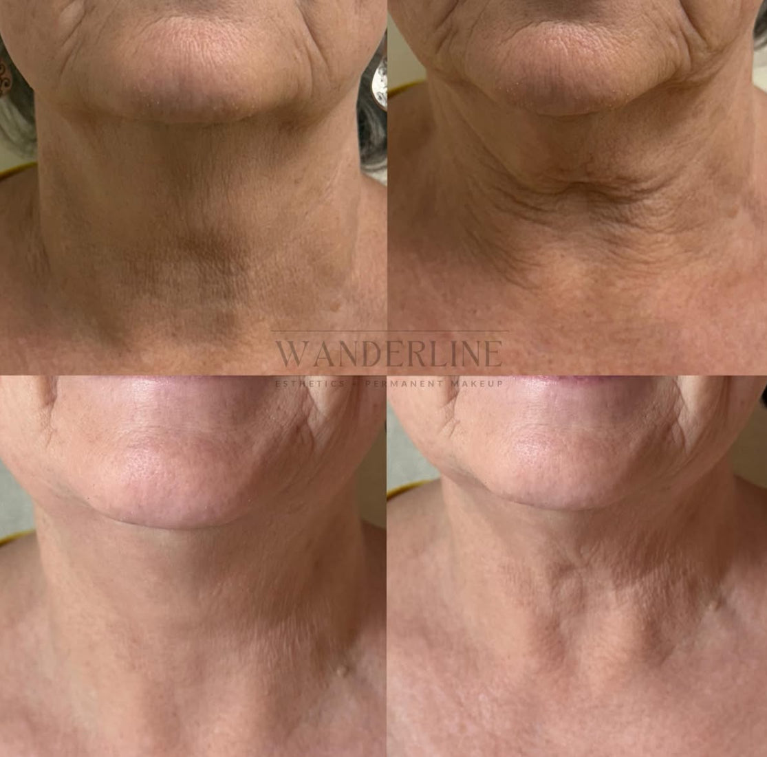 The Neck Lifting Intensive Firming Cream 1.69 oz